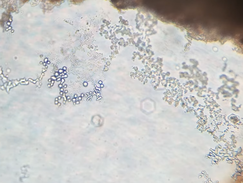 microscopic yeast bubbles