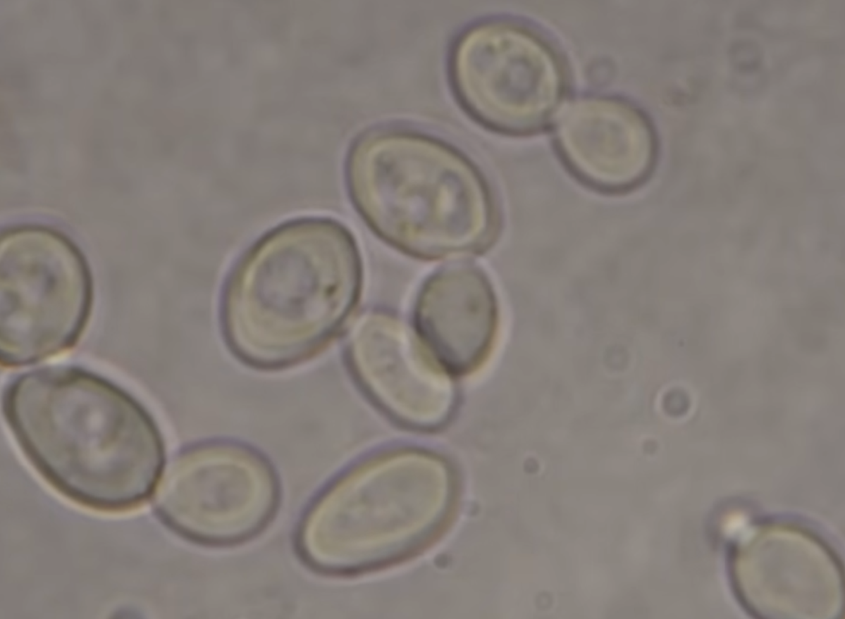 budding yeast cells