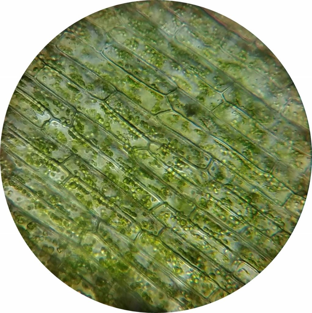 waterweed plant cell under a microscope